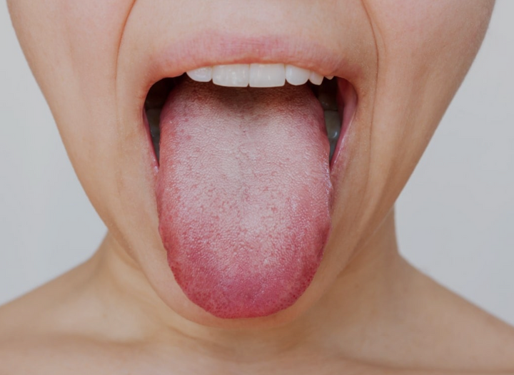 Bad breath, bloating, and bacteria: Why it’s all connected