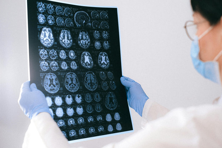 Women, Alzheimer’s, and Dementia: Are We at Greater Risk, and How Can We Protect Ourselves?