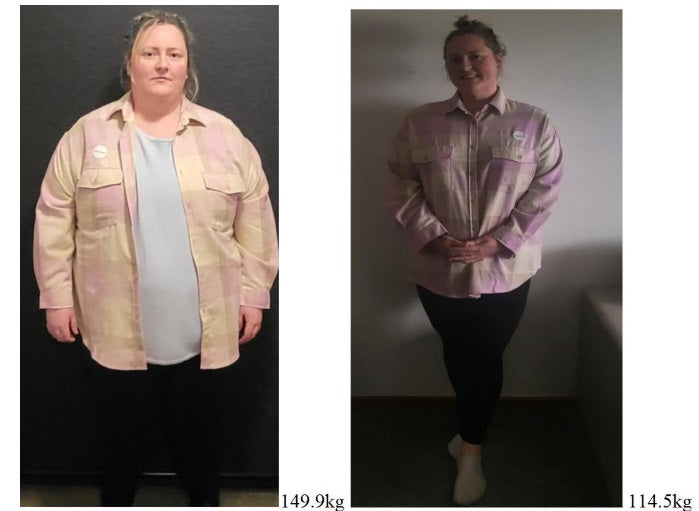 Brooke is following Zing Wellbeing for support after having weight loss surgery