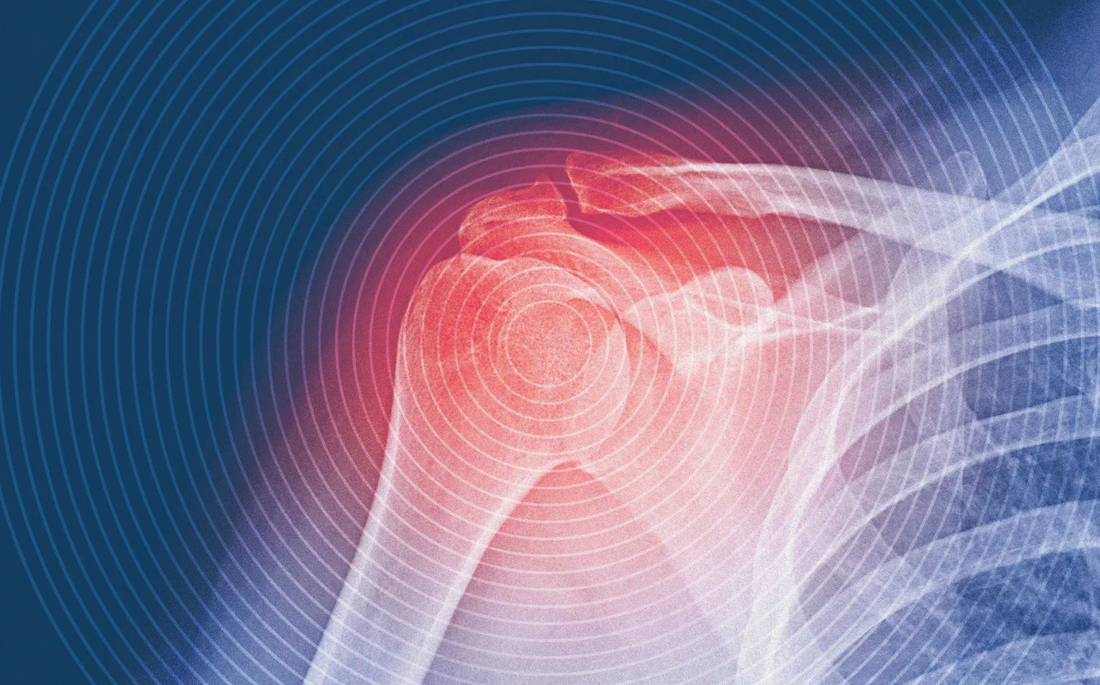 10 signs of inflammation in the body and how to reduce it