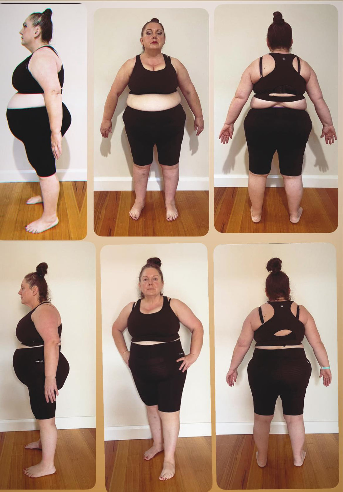 Julijana has gone from bra size 24DD to 16E