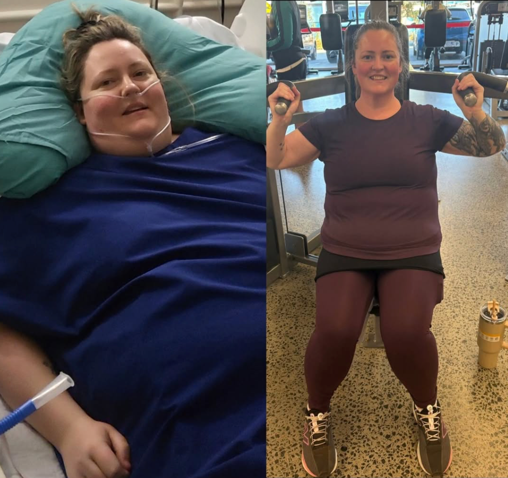 Brooke's 47kg Weight Loss & The INSANE Health Benefits She Is Seeing